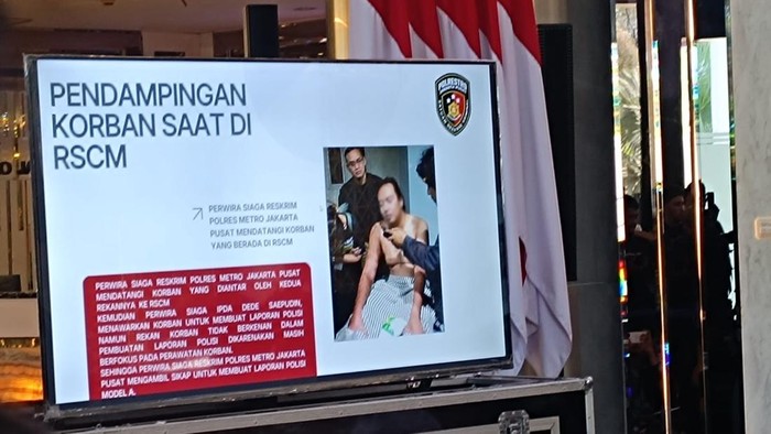 polda-metro-jaya-gelar-konferensi-pers-update-kasus-penyiraman-air-keras-ke-aktivis-kontras-andrie-yunus-rizkydetikcom-1773639779972_169